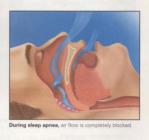Grafika oddychania ustami i nosem